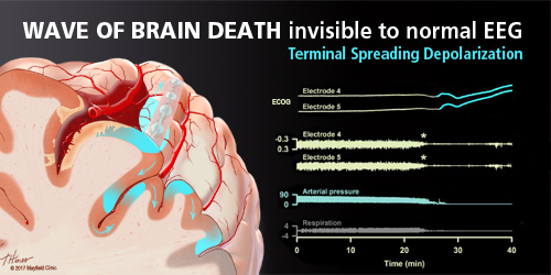 When is clinical 2025 deat